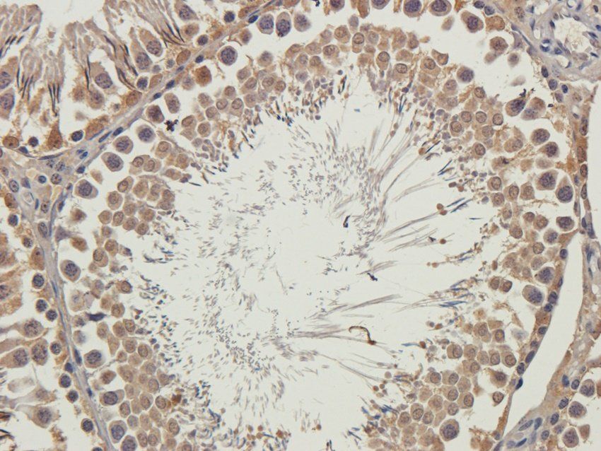 WDFY1 Rabbit Polyclonal Antibody
