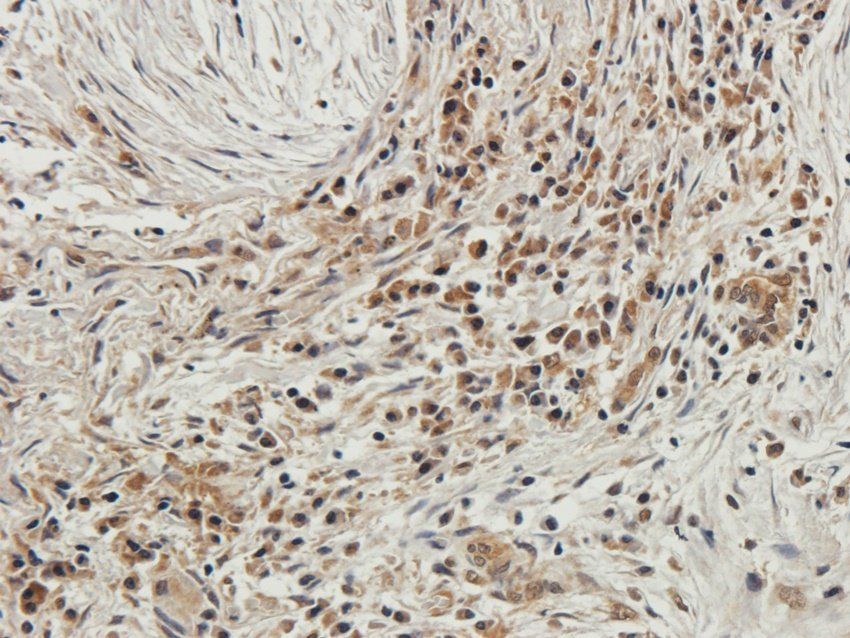 WDFY1 Rabbit Polyclonal Antibody