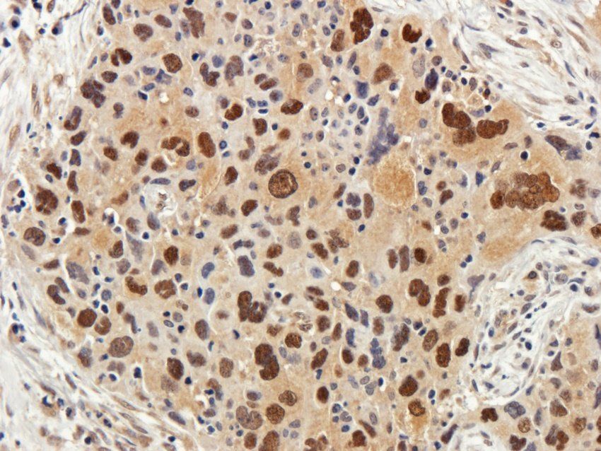 WDFY1 Rabbit Polyclonal Antibody