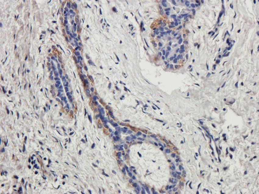 WDFY1 Rabbit Polyclonal Antibody