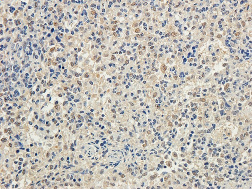 WDFY1 Rabbit Polyclonal Antibody