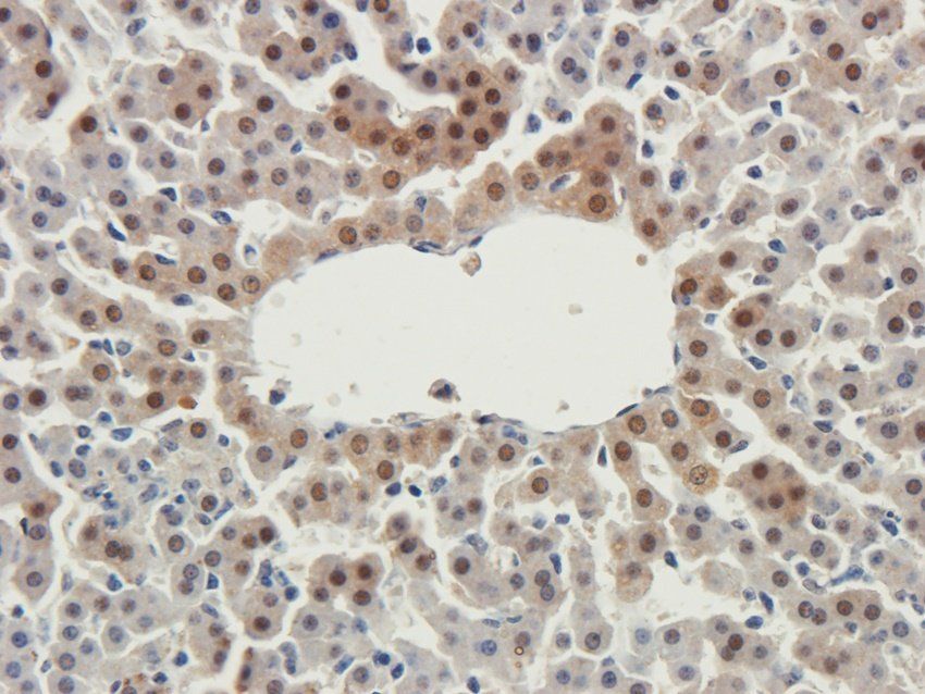 WDFY1 Rabbit Polyclonal Antibody