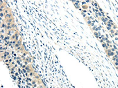 WNK3 Antibody
