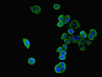 WNK4 Antibody