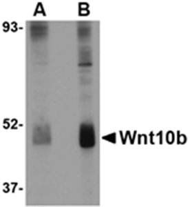 Wnt10b Rabbit Polyclonal Antibody