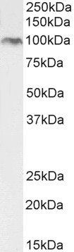 BMP1 (aa284-296) Antibody