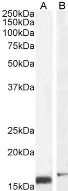 RBP1 Antibody