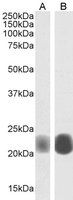 Caveolin 1 Antibody
