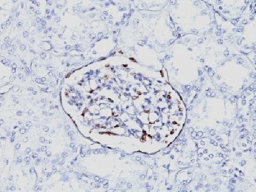 WT1 Antibody