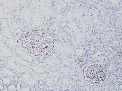 WT1 Antibody