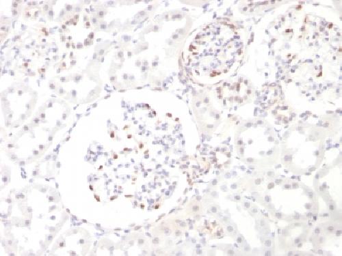WT1 Antibody