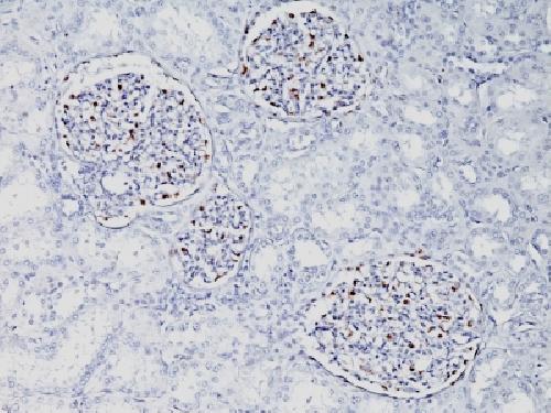 WT1 Antibody