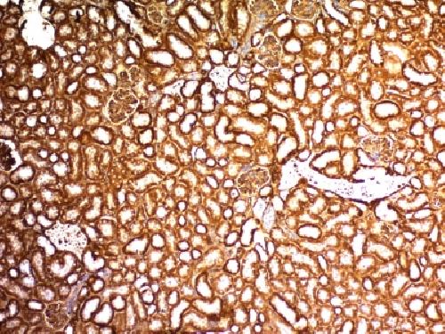 WT1 Antibody