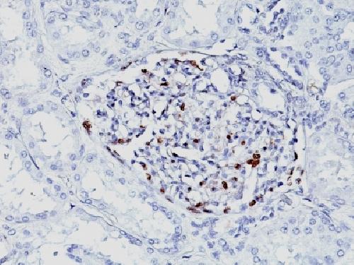WT1 Antibody