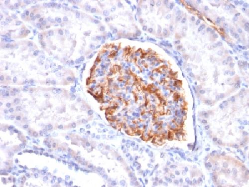 WT1 Antibody