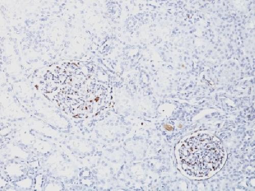 WT1 Antibody