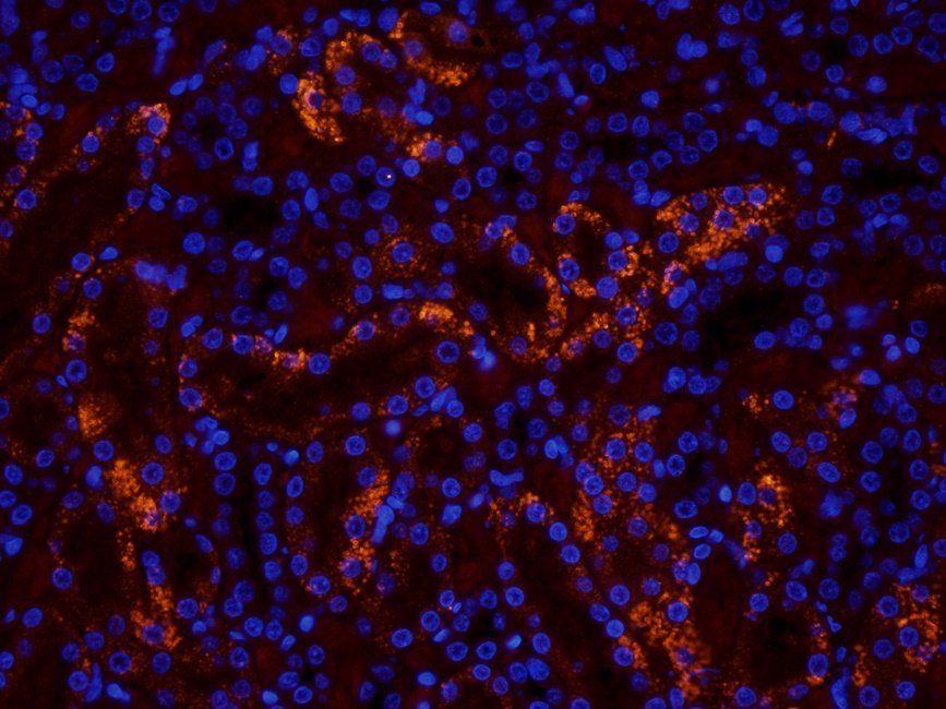 WWTR1 Rabbit Polyclonal Antibody