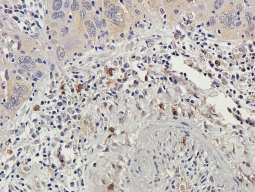 WWTR1 Rabbit Polyclonal Antibody