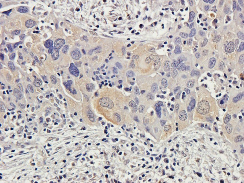 WWTR1 Rabbit Polyclonal Antibody
