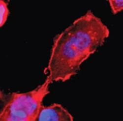 Mouse anti Human Sphingosine 1 Phosphate 4 Receptor (CT) (EDG6) Antibody