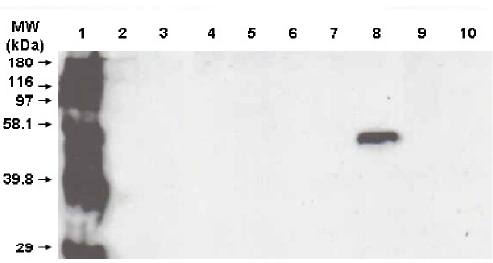 Mouse anti Human Cytochrome P450 3A5 Antibody