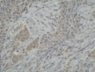 Mouse anti Human Cytochrome P450 3A5 Antibody