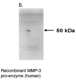 Mouse anti Human Matrix Metalloproteinase 3 (MMP3) Antibody