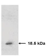 Mouse anti Human Tissue Inhibitor of Matrix Metalloproteinase 2 (TIMP2) Antibody