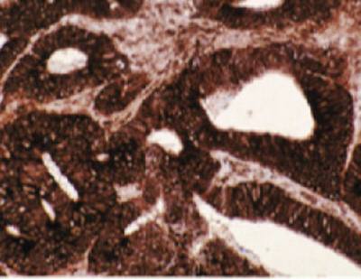 Mouse anti Human T-Complex Protein 1 Antibody, subunit