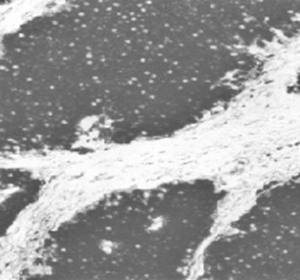 Mouse anti Human Enolase Antibody