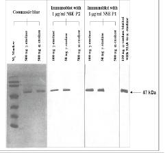 Mouse anti Human Enolase Antibody