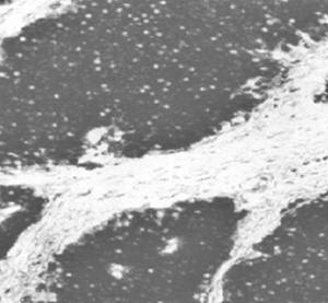 Mouse anti Human Neuron-Specific Enolase Antibody