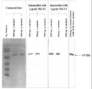 Mouse anti Human Neuron-Specific Enolase Antibody