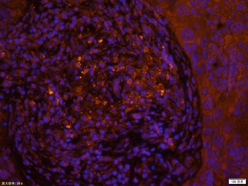 XRCC1 Rabbit Polyclonal Antibody