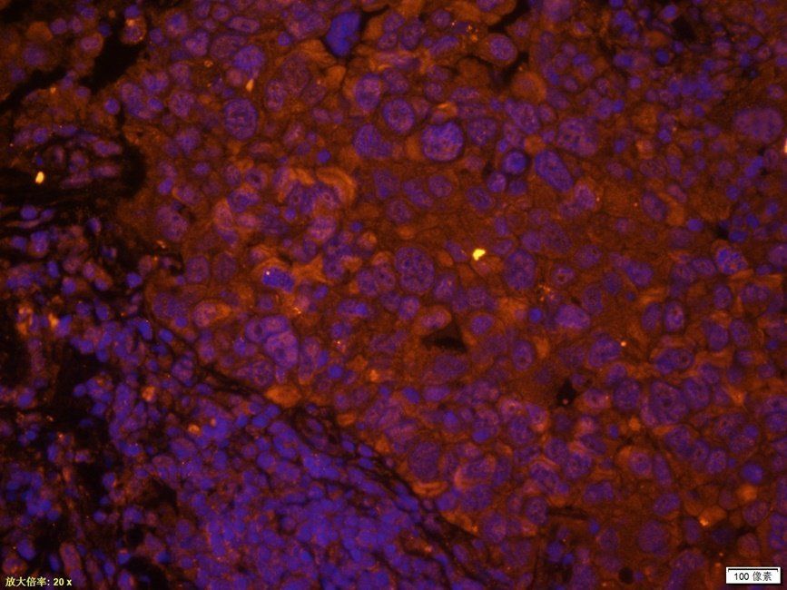 XRCC1 Rabbit Polyclonal Antibody