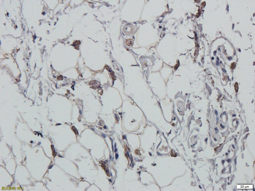 XRCC1 Rabbit Polyclonal Antibody