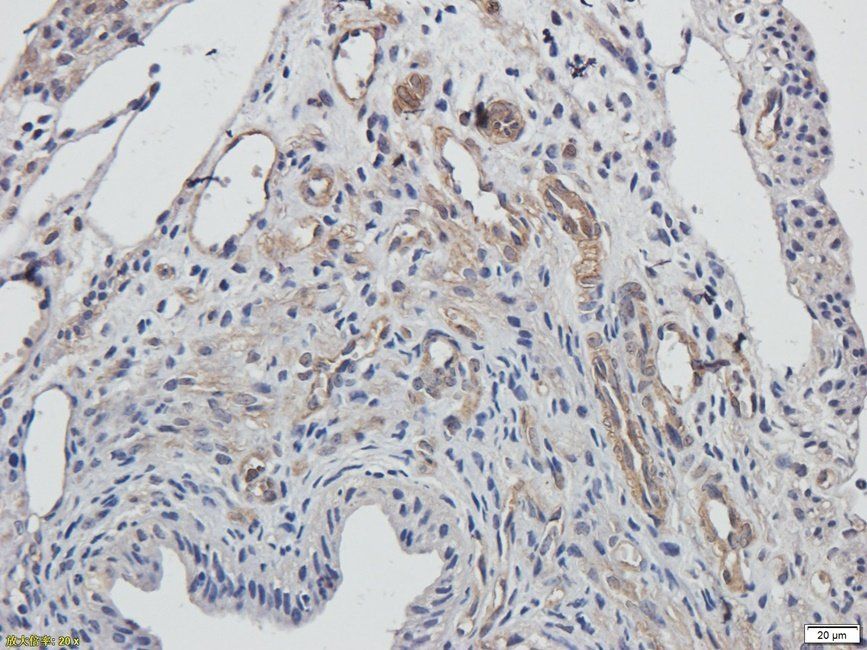 XRCC1 Rabbit Polyclonal Antibody