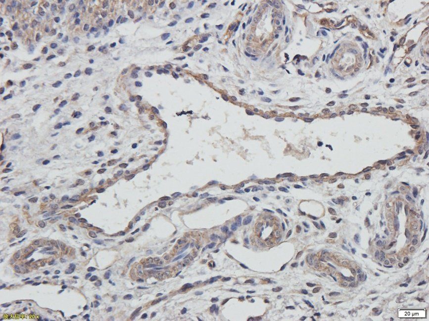 XRCC1 Rabbit Polyclonal Antibody