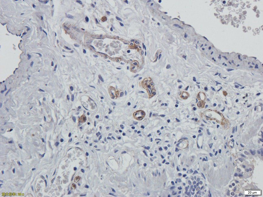 XRCC1 Rabbit Polyclonal Antibody