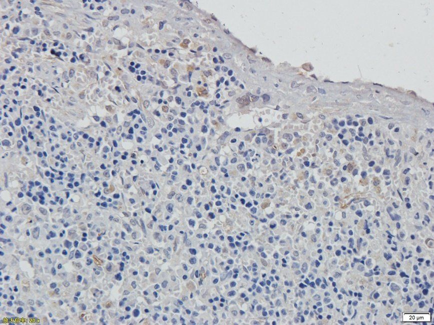 XRCC1 Rabbit Polyclonal Antibody