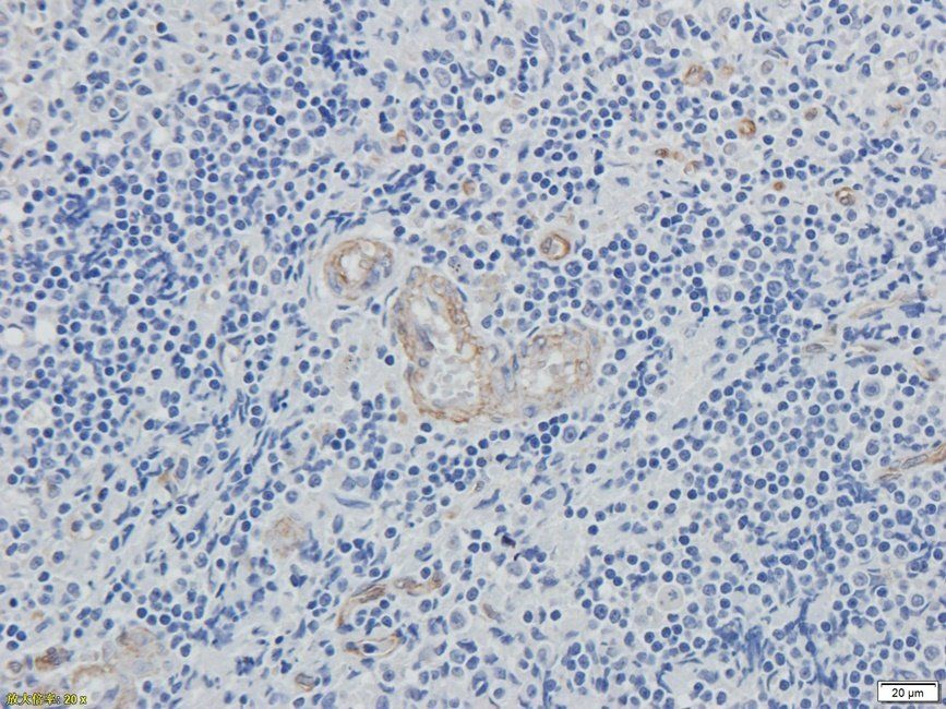 XRCC1 Rabbit Polyclonal Antibody