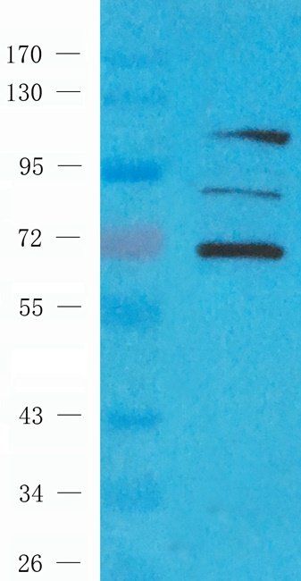 XRCC1 Rabbit Polyclonal Antibody