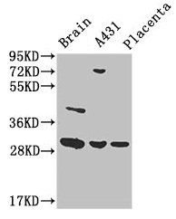 YWHAG Antibody