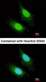 ZC3H12A Rabbit Polyclonal Antibody