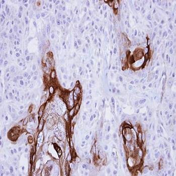 ZC3H12A Rabbit Polyclonal Antibody