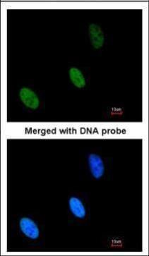 ZHX2 Rabbit Polyclonal Antibody