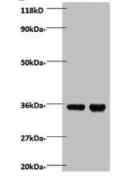 ZBED1 Antibody