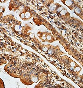 ZNF193 Rabbit Polyclonal Antibody