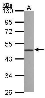 IRAK3 Rabbit Polyclonal Antibody