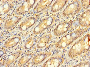 ZNF562 Antibody